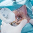 Laser refractive & cataract surgery