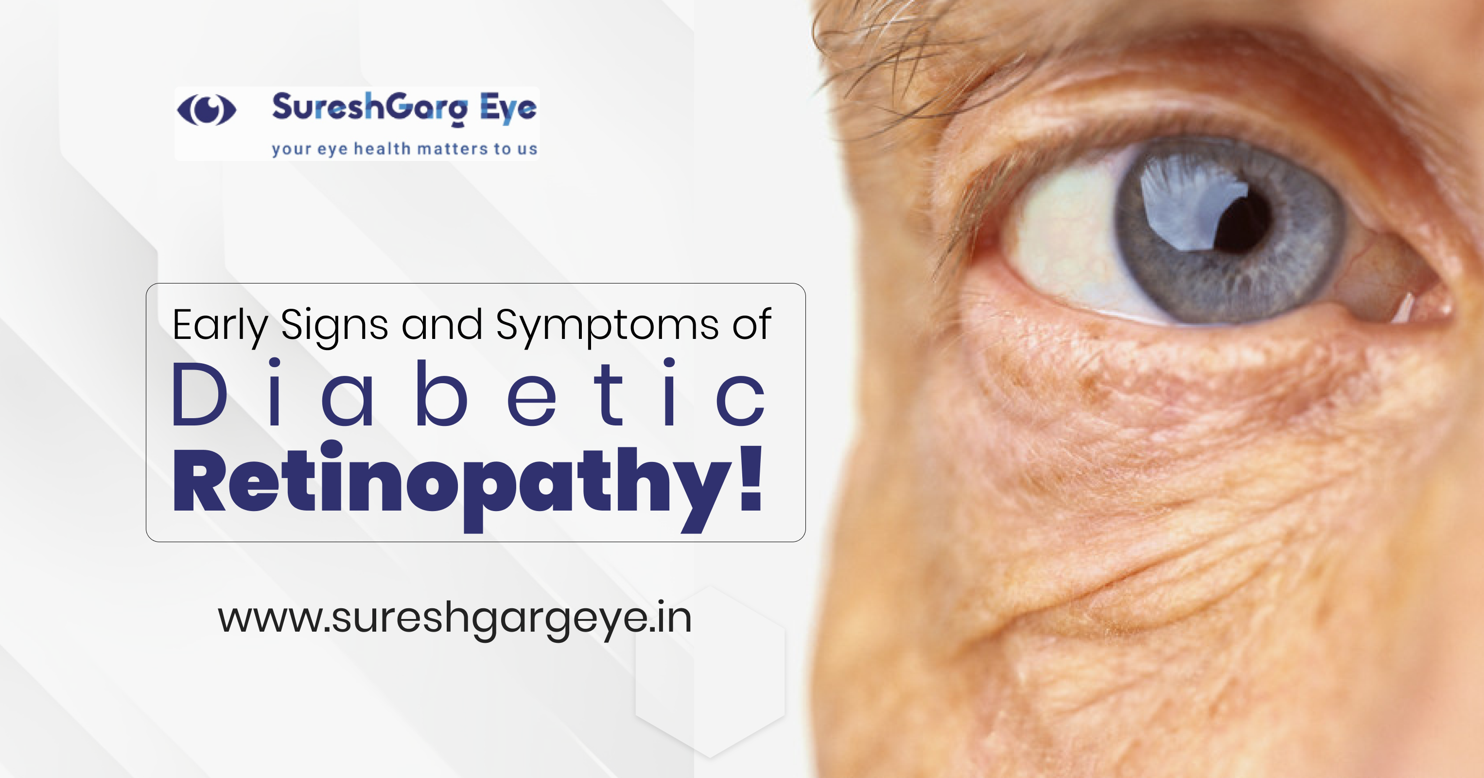 Early Signs and Symptoms of Diabetic Retinopathy!