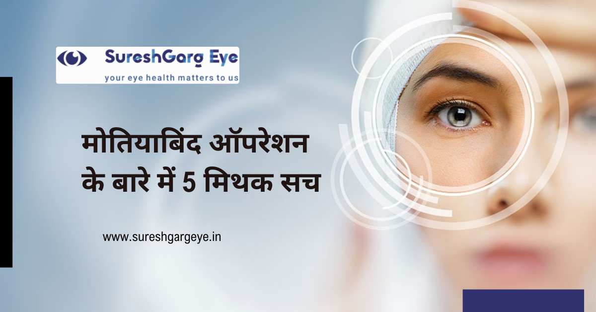 मोतियाबिंद सर्जरी के बारे में 5 मिथक सच
