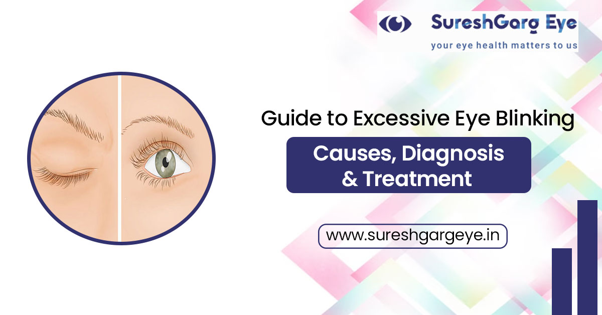 Guide to Excessive Eye Blinking: Causes, Diagnosis & Treatment