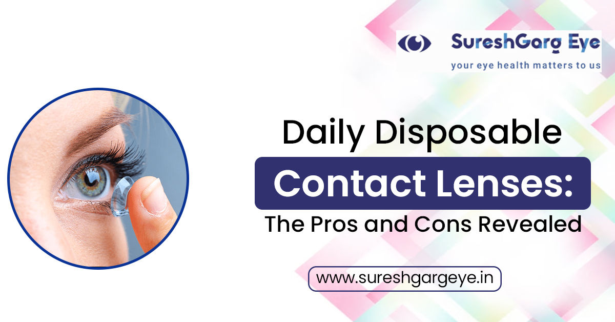 Daily Disposable Contact Lenses: The Pros and Cons Revealed